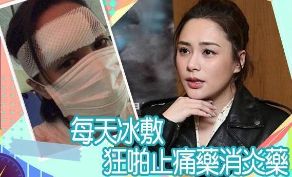阿娇伤口6天后拆线经纪公司 希望疤痕不大 人在洛杉矶网lapeople Com