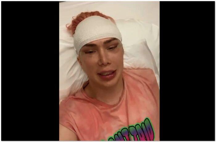 英国网红整容18次后宣布变成韩国人 人在洛杉矶网lapeople Com