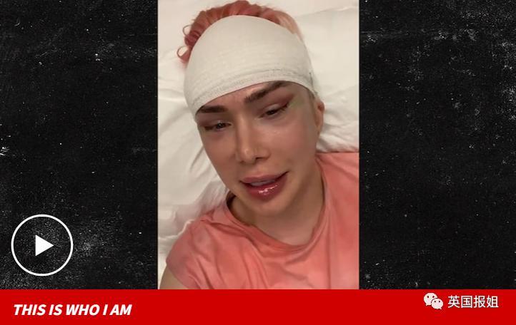 英国男砸百万整容18次毁容 怒称自己是韩国人 人在洛杉矶网lapeople Com