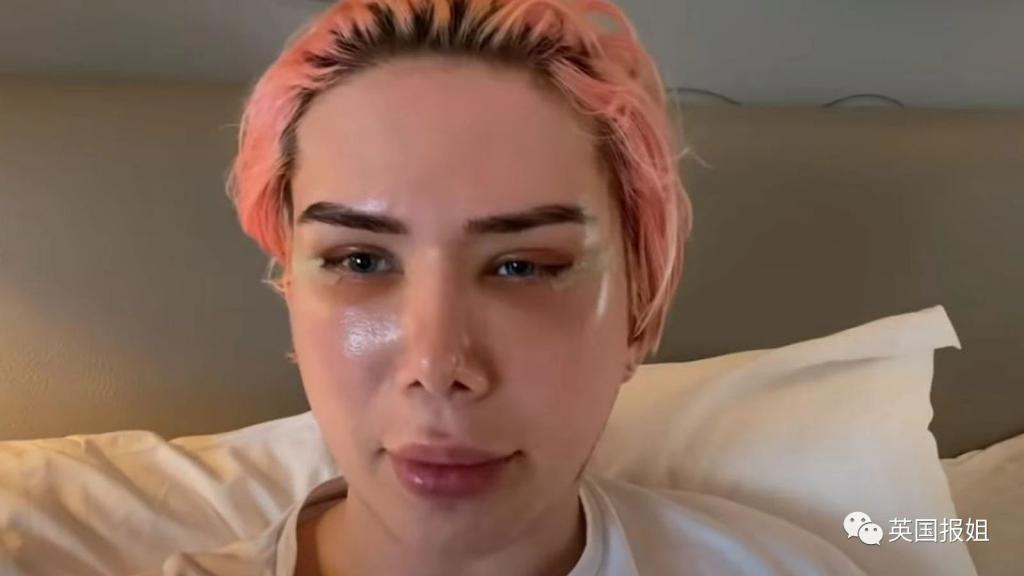 英国男砸百万整容18次毁容 怒称自己是韩国人 人在洛杉矶网lapeople Com